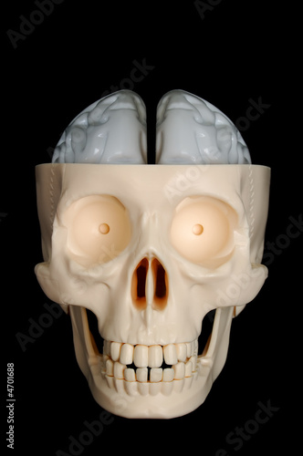 Skull with Exposed Brain