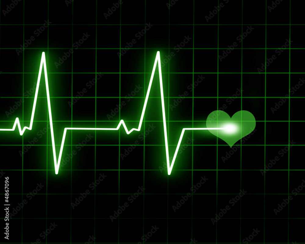 Heart monitor Heart monitor