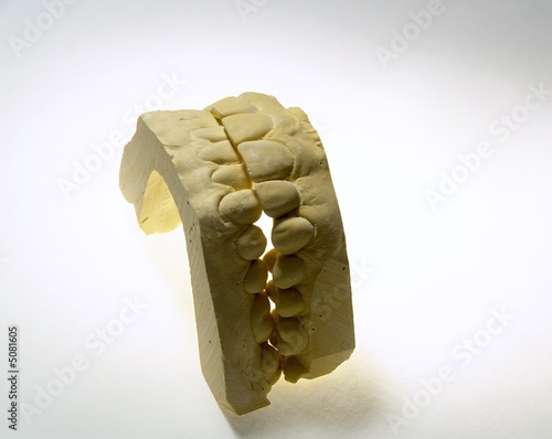 Teeth Mold Dentistry