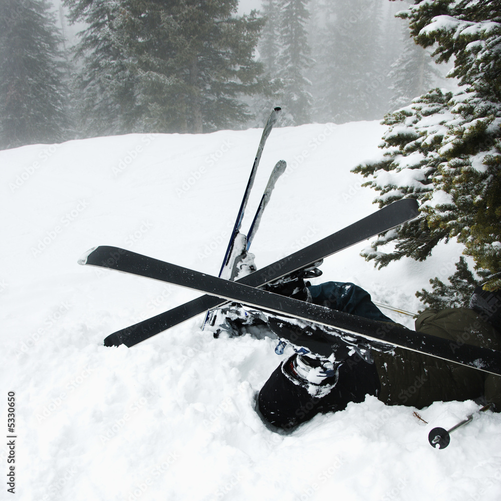 Ski accident. Stock Photo Adobe Stock