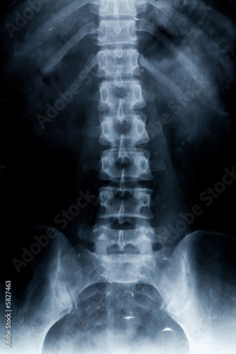  body x-ray photo