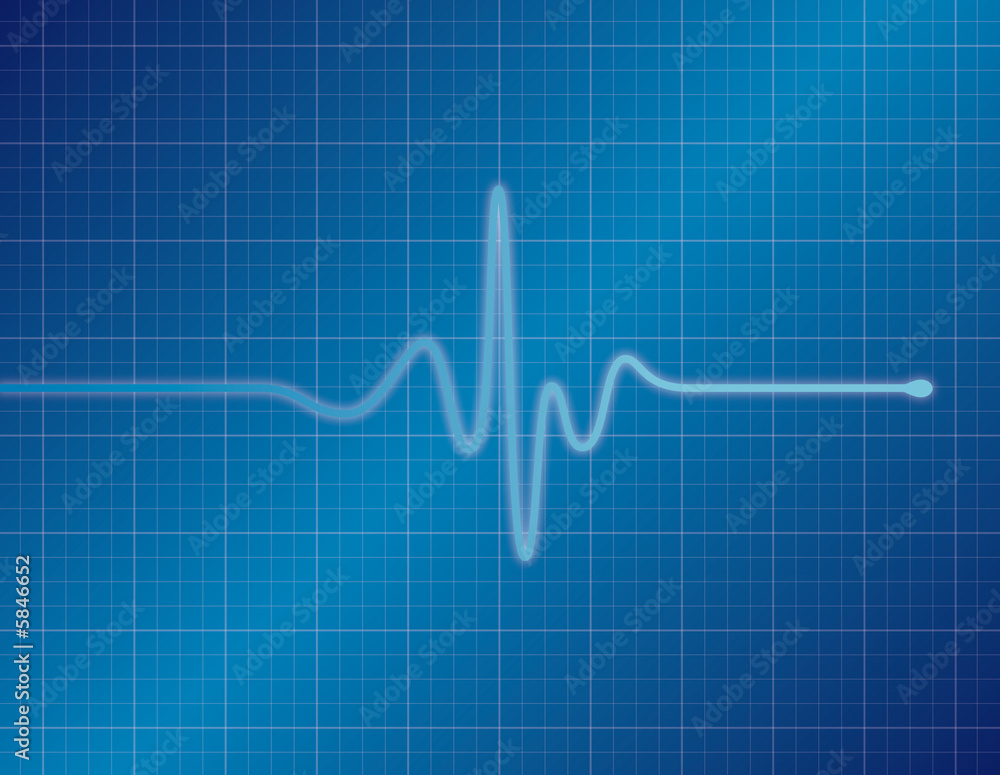 Single pulse blue medical EKG (ECG) graph Single pulse blue medical EKG (ECG) graph