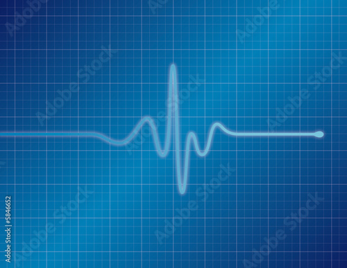 Single pulse blue medical EKG (ECG) graph