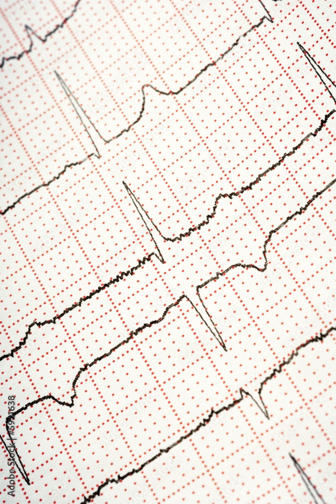 electrocardiogram - closeup
