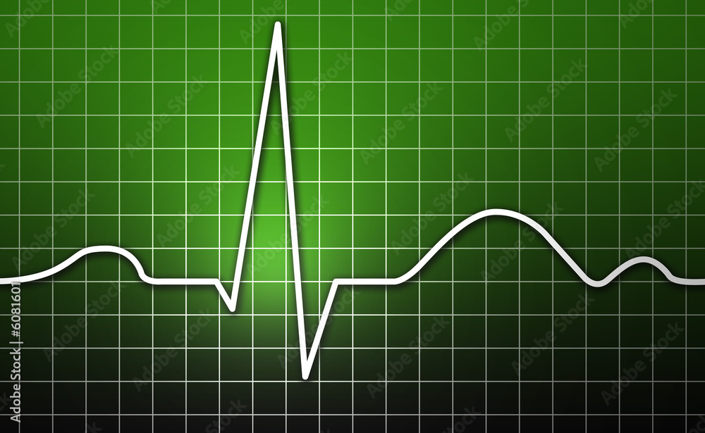 EKG, Herz, Kardiogramm EKG, Herz, Kardiogramm