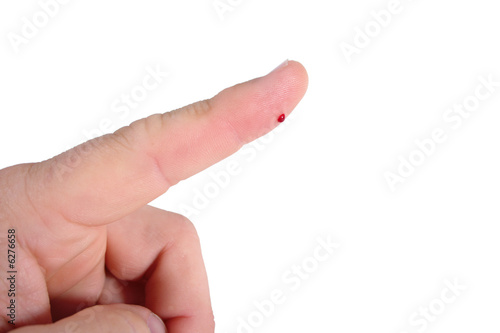 Drop of blood on a finger for a blood glucose test