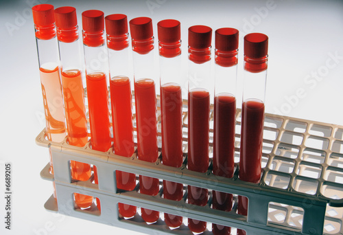 Provette con soluzione rossa
