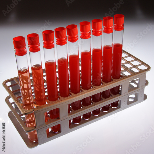 Test-tube whit red sample  