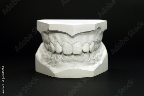 ypsum model plaster of tooth - Front view