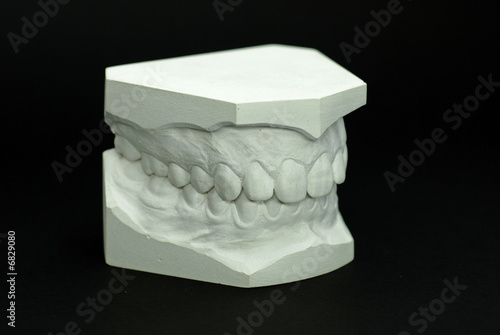 Gypsum model plaster of tooth - Side view