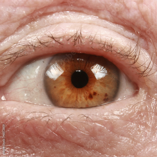 Auge