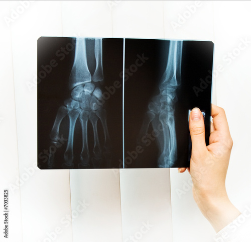 medic holding roentgen of the hand