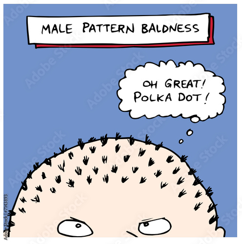 Male Pattern Baldness