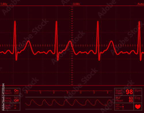 heart monitor screen