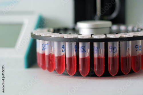 test of blood