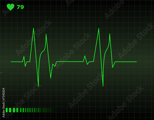 Heart monitor