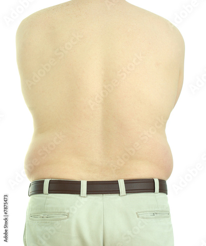 Canvas-taulu Male obesity