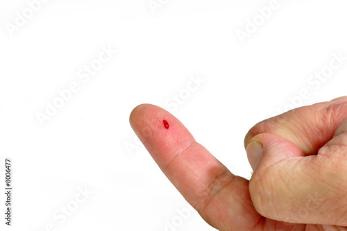 Blutiger Zeigefinger