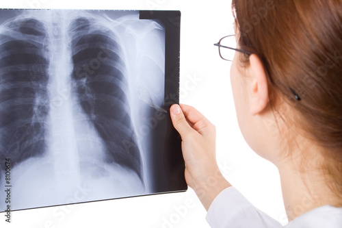 Female doctor examining a thorax x ray.