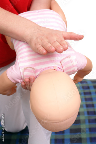 Infant suffocation rescue technique photo