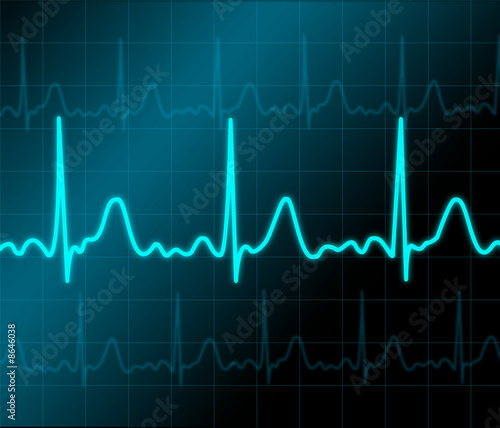 Heart monitor