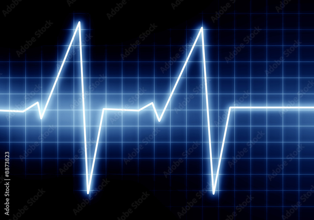 heart beat on a clinic monitor on a dark background heart beat on a clinic monitor on a dark background