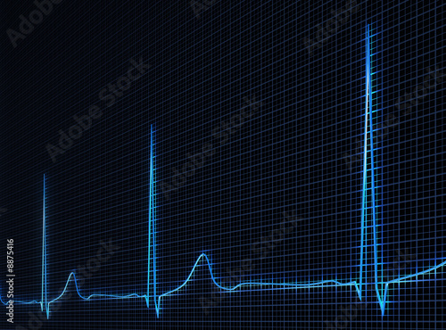 Fotografía Cardiogram