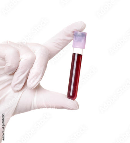 hand holding blood in test tube close up