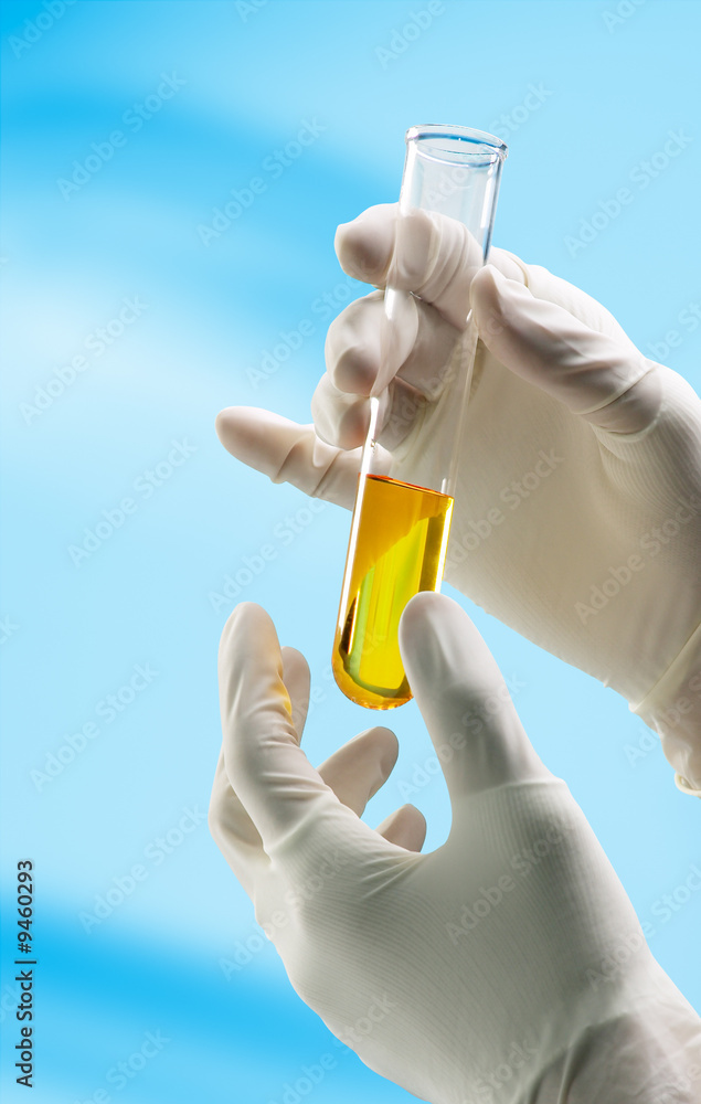 hands with glove holding a test tube hands with glove holding a test tube