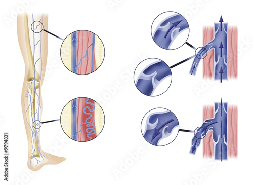 leg artery