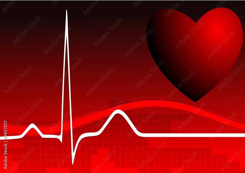 Electrocardiogramme