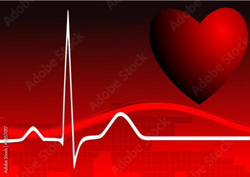 Electrocardiogramme