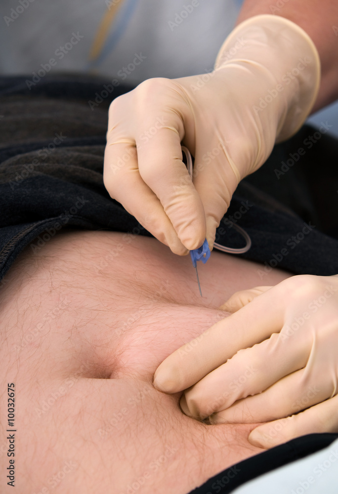 Prick close up in a stomach Prick close up in a stomach