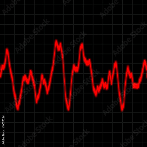 Illustration of the electrical activity of the human heart.