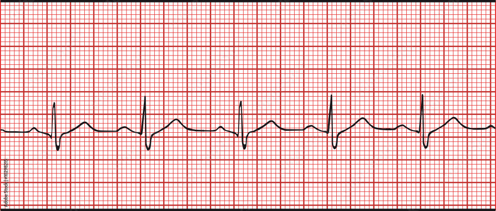 Normal electronic cardiogram vector illustration