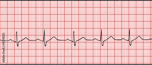 Normal electronic cardiogram vector illustration