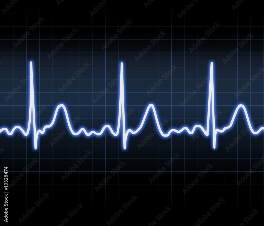 Heart monitor Heart monitor
