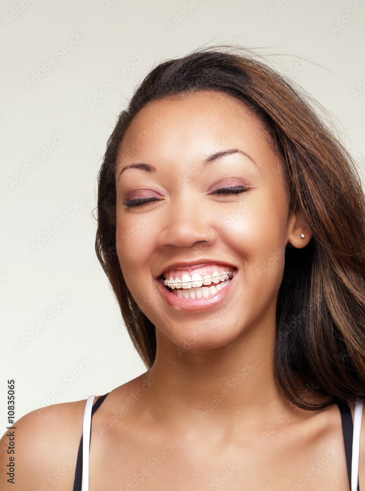Young black woman with big smile braces Young black woman with big smile braces