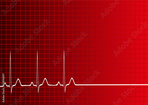 electrocardiogramme