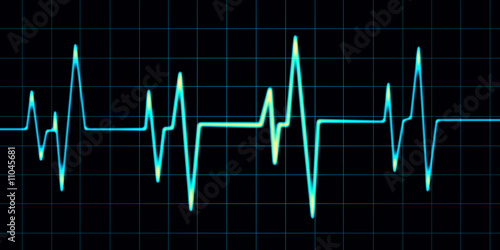 cardiogram (blue)