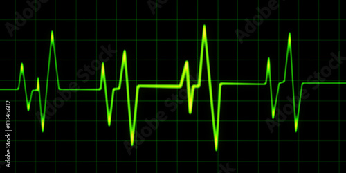 cardiogram (green)