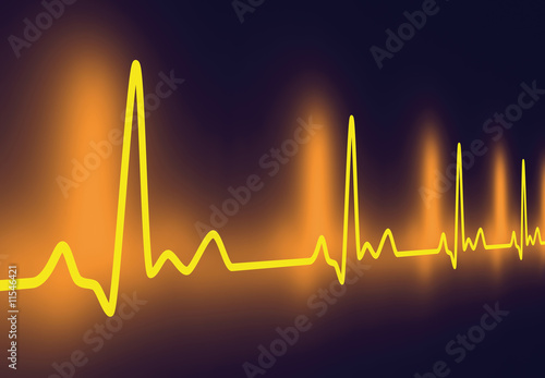 EKG Puls photo