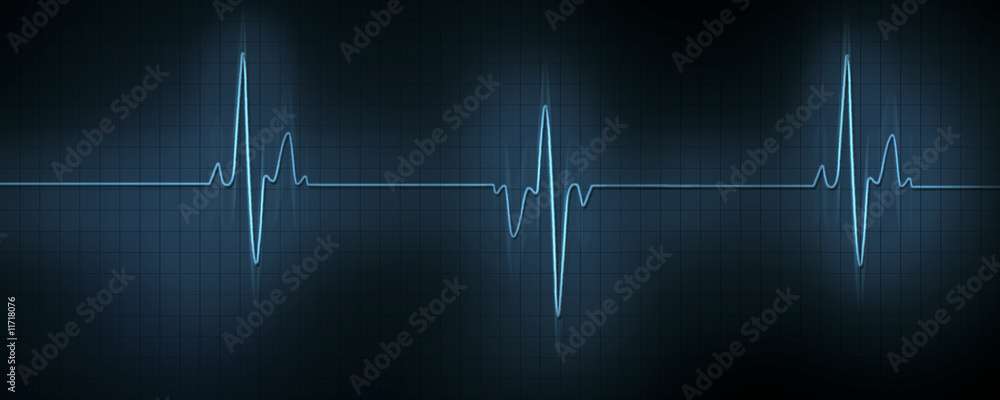 Heart Beat Heart Beat