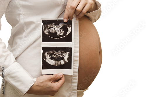 Embarazada mostrando ecografia photo