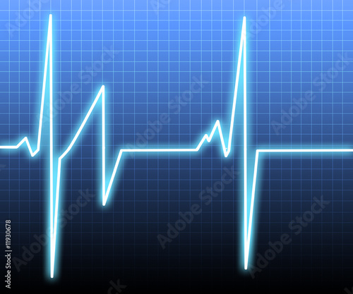 Cuadro en lienzo Heart beat on an ecg