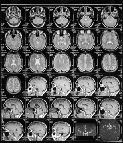 head magnetic resonance image