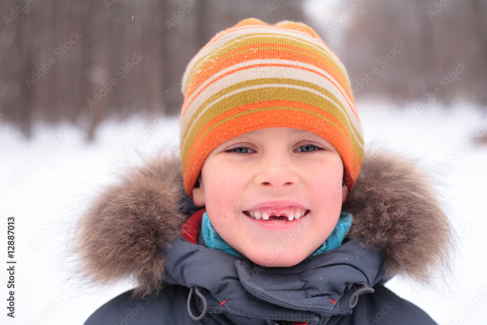 smiling boy without foreteeth smiling boy without foreteeth