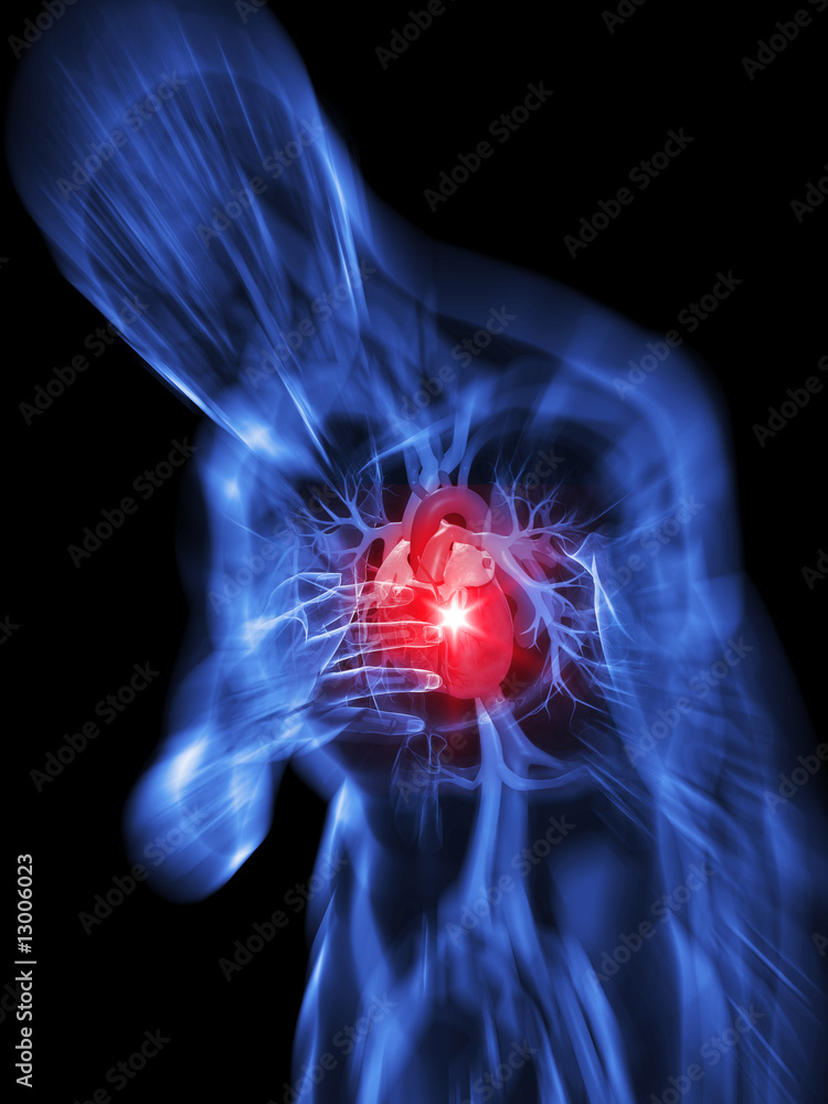 Fotografie herzschmerzen / herzinfarkt