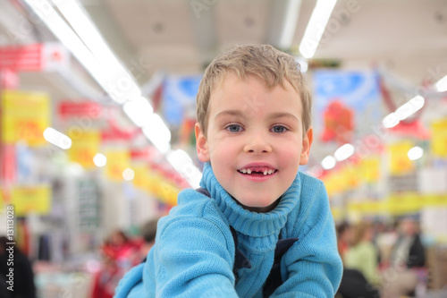 boy without foreteeth in shop