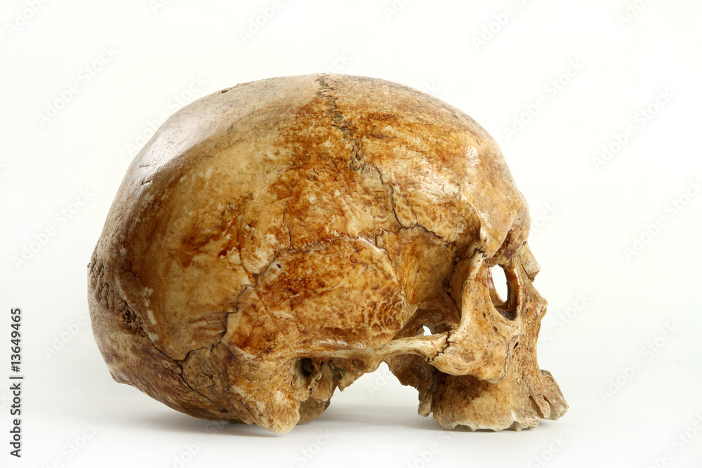 Skull Skull